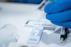 Nahaufnahme Corona Antigen-Schnelltest